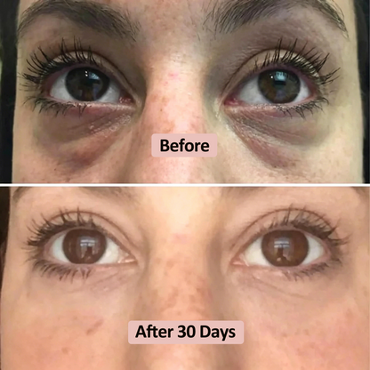 Saniviacn® Microneedle Under Eye Patch