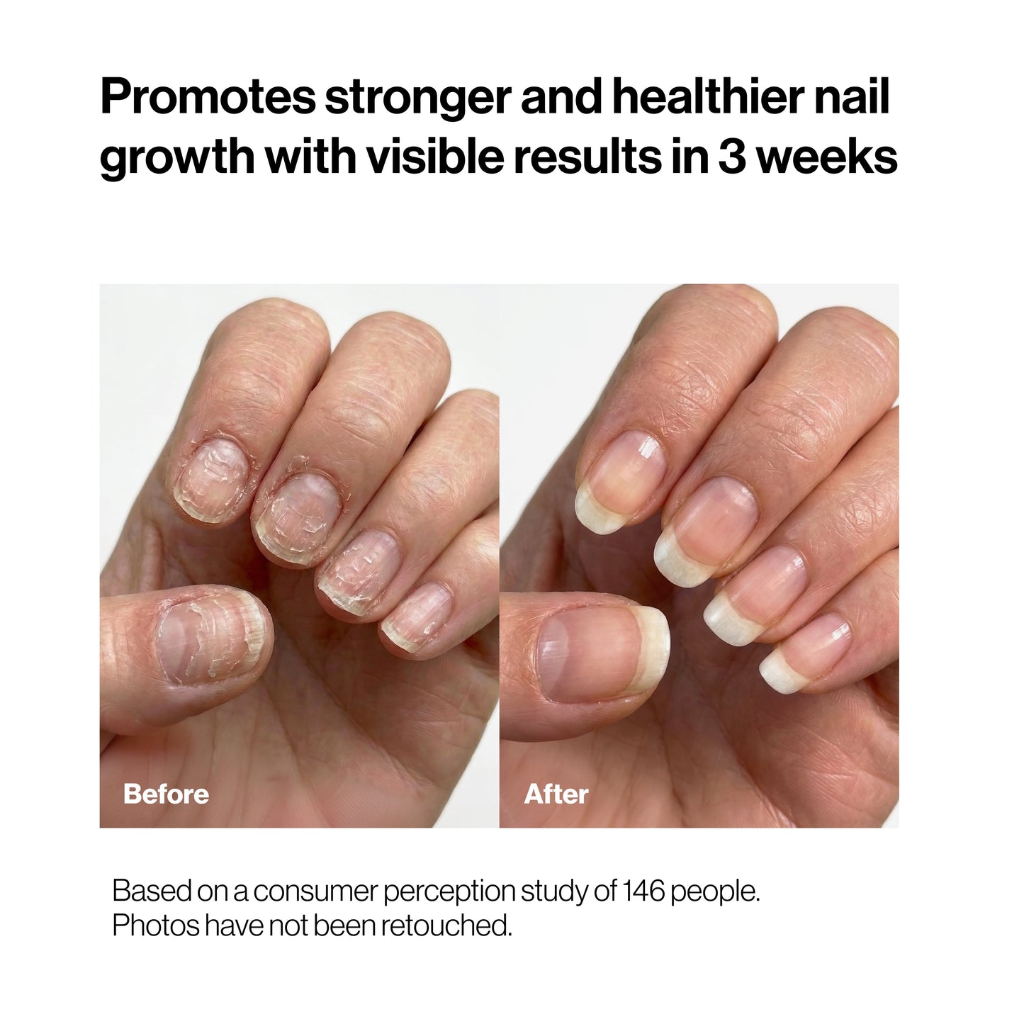 Saniviacn® 2026 🔥 Nourishing Nail Pen | For Healthy & Strong Nails