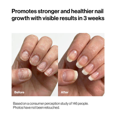 Saniviacn® 2026 🔥 Nourishing Nail Pen | For Healthy & Strong Nails