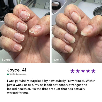Saniviacn® 2026 🔥 Nourishing Nail Pen | For Healthy & Strong Nails